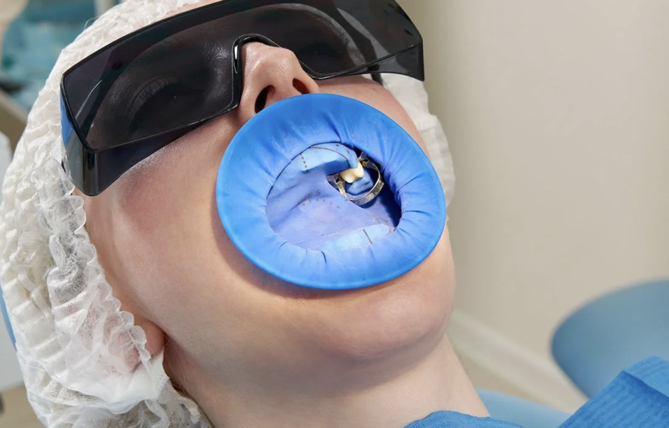 Giải pháp cô lập răng với Bộ đặt đê cao su – Bước tiến quan trọng trong nha khoa hiện đại